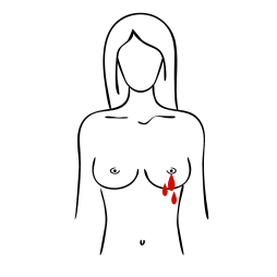 Écoulement du mamelon