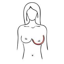 Changement de la taille ou de la forme